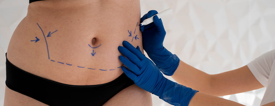 GIOVANNI-MARTINS-IMAGEM-INTERNA-Plástica-abdominal